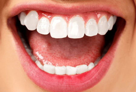 View Heard of the oral microbiome? Close up image of large mouth in smile showing all front teeth