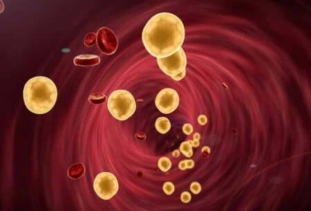 View Cholesterol