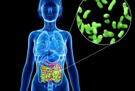 View Intestinal Methanogenic Overgrowth (IMO)