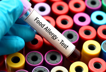 Image shows a testing tube being held with the text 'Food Allergy - Test'